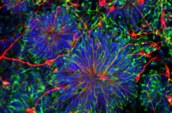 A Prkci Gene Keeps Stem Cells in Check