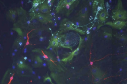 Cerebrospinal fluid signals control the behavior of stem cells in the brain