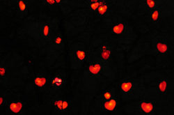 Cardiac Stem Cells from Young Hearts Could Rejuvenate Old Hearts, New Study Shows