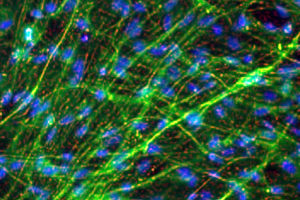 Human-iPSC-derived-neurons